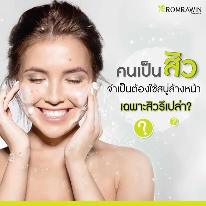 คนเป็นสิว จำเป็นต้องใช้สบู่ล้างหน้าเฉพาะสิวรึเปล่า?
