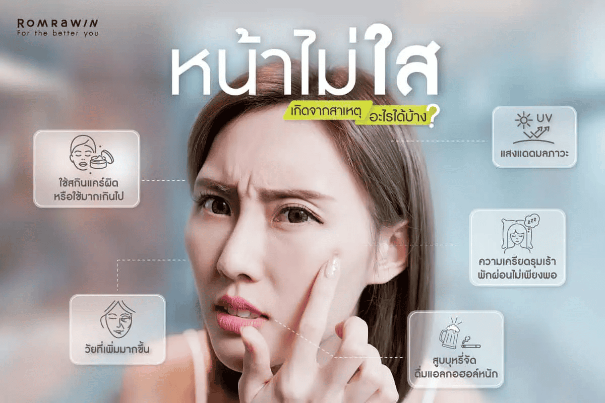 หน้าใสไร้สิว