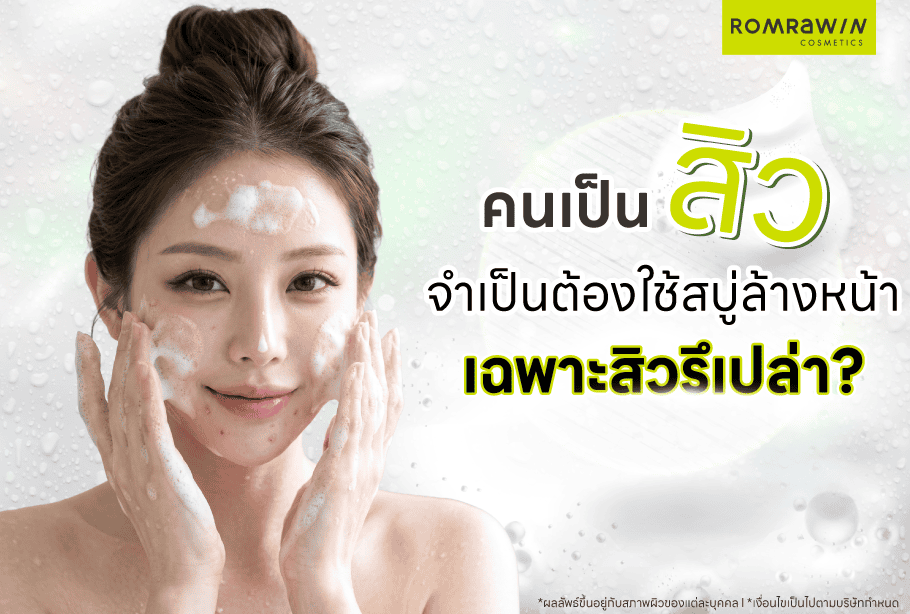 คนเป็นสิวใช้สบู่ล้างหน้าได้หรือเปล่า