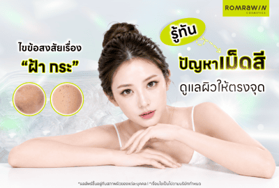 ไขข้อสงสัยเรื่อง “ฝ้า กระ” รู้ทันปัญหาเม็ดสี ดูแลผิวให้ตรงจุด
